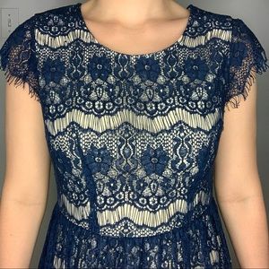 Lace Party Dress
